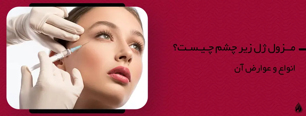 از مزوژل زیر چشم به عنوان جوانسازی استفاده می شود.